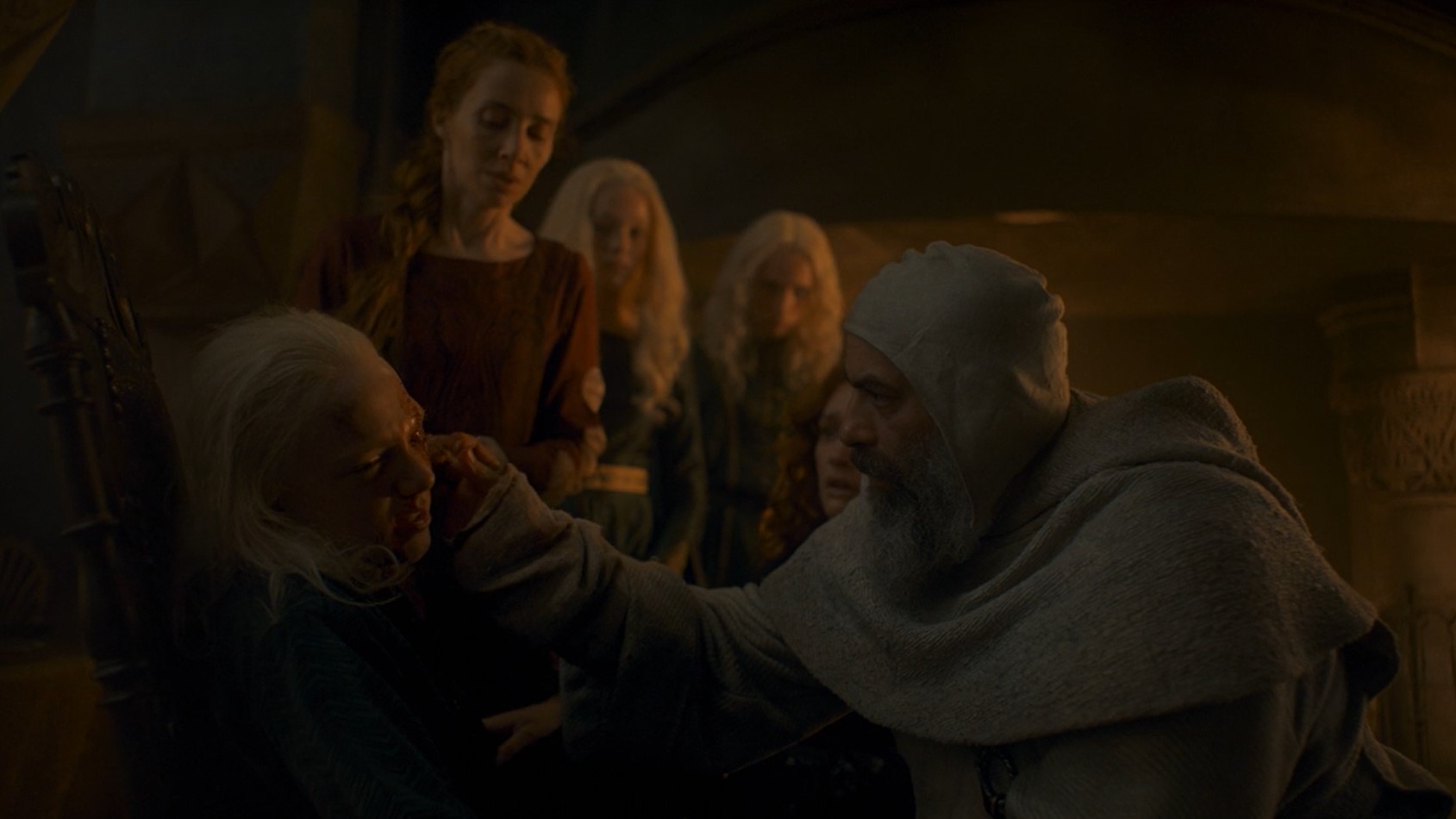 Which Targaryen kid loses his eye in House of the Dragon Episode 7?